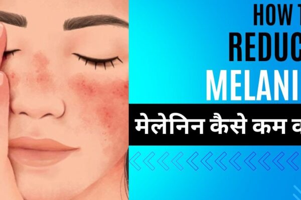 How to Reduce Melanin in Skin Permanently by Eating