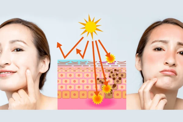 how to reduce melanin in skin naturally