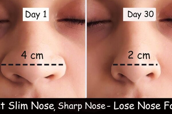 how to reduce nose fat