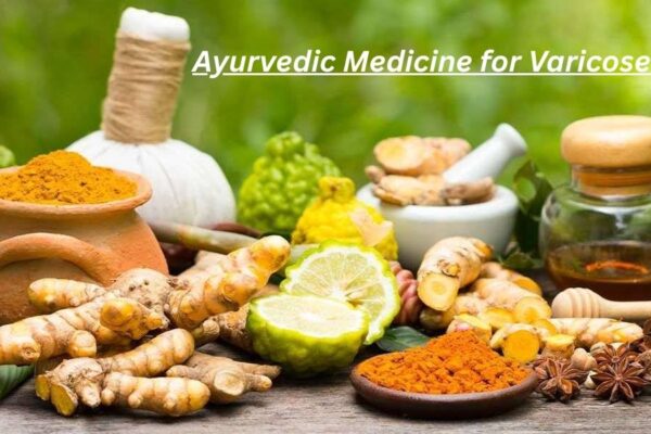 Ayurvedic Medicine for Varicose Veins: 10 Proven Fixes