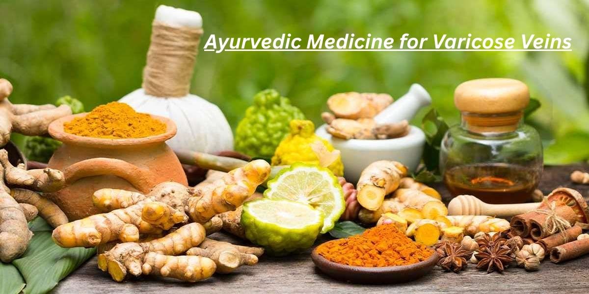 Ayurvedic Medicine for Varicose Veins: 10 Proven Fixes