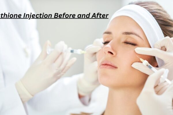 7 Real Glutathione Injection Before and After Results