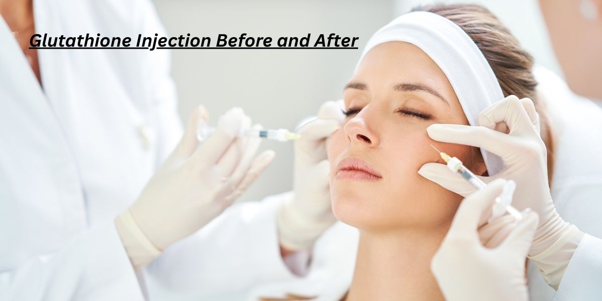 7 Real Glutathione Injection Before and After Results