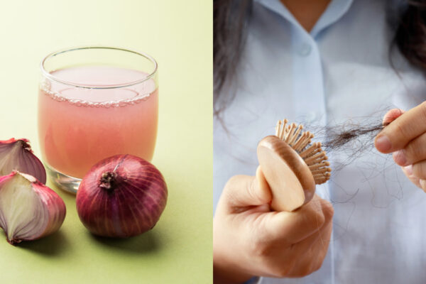 Onion Benefits for Hair Growth & Hair Fall Control