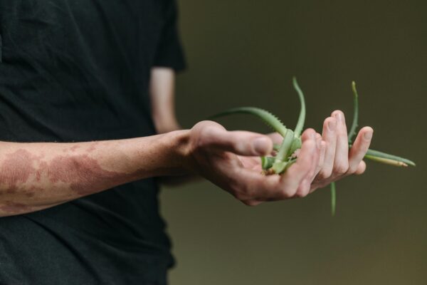 Benefits of Aloe Vera Gel for Hair Growth & Strength